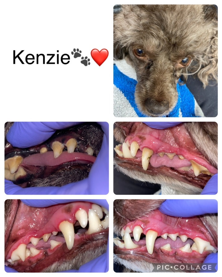 Cosmetic Teeth Cleaning